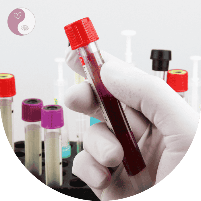 DHEA Diagnose Bluttest DHEA Diagnose Bluttest